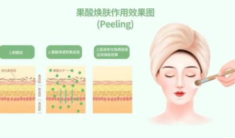 如何避免果酸换肤后复发