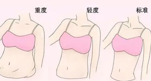 腰部吸脂后的修复时间