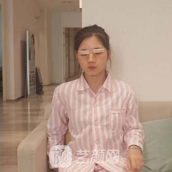 丁合军简介怎么样？医生详细资料+双眼皮整形实例