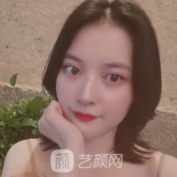 杨永胜医生怎么样？做双眼皮真实实例，细节展示技术风格