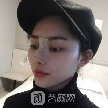 福州名韩温名赟医生做鼻子靠谱吗？医生简介+隆鼻实例更新