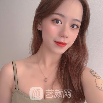 范锟铻隆胸实例前后对比图，轻松拥有饱满胸型