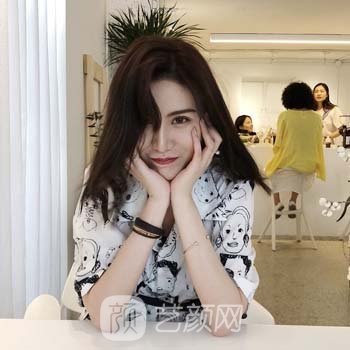 牛永敢做的鼻子实例：改善了鼻子，术后自信又乐观