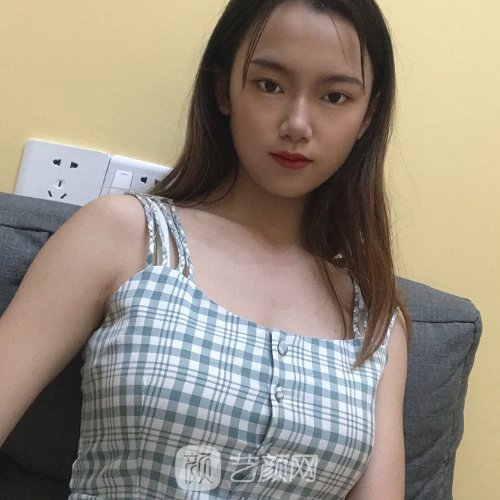 杭州胡学庆自体脂肪隆胸实例展示？内含体验对比图