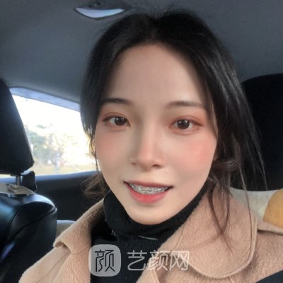 上海科美口腔门诊部牙齿正畸实例出炉｜内附体验成果图