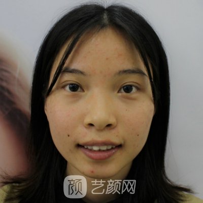 上海科美口腔门诊部牙齿正畸实例出炉｜内附体验成果图