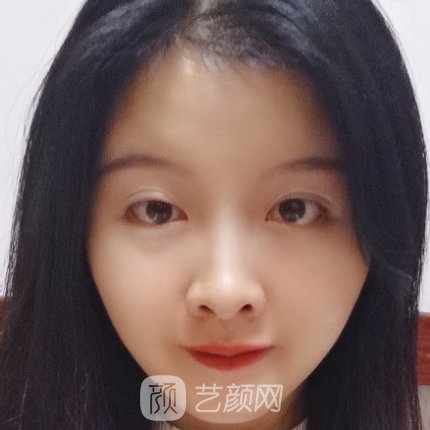 广州市皮肤病防治所龚业青皮肤除皱实例公开｜附体验对比图
