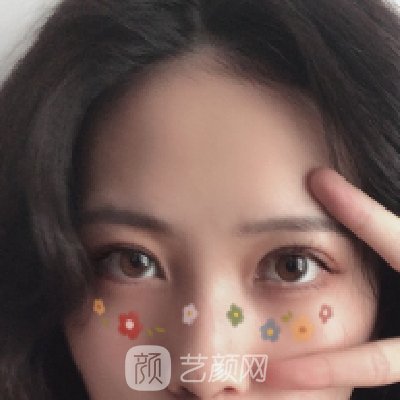 广州越秀紫馨曹仁昌修复眼睛真的厉害吗？？2022招牌实例公开