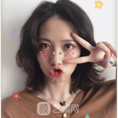广州越秀紫馨曹仁昌修复眼睛真的厉害吗？？2022招牌实例公开