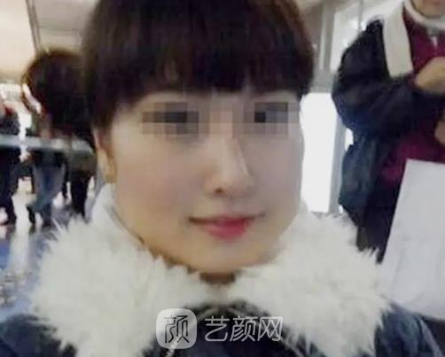 上海华美做下颌角怎么样？2022招牌实例出炉