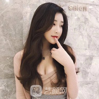 齐齐哈尔市第一医院整形科割双眼皮实例公开|附体验成果图