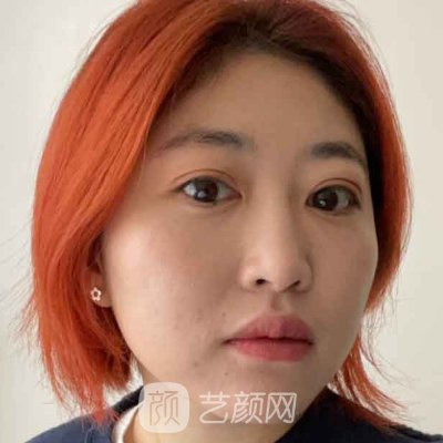 北京协和医院黄渭清做眼袋手术怎么样？全新体验实例一览