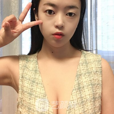 重庆美莱汪灏医生做胸怎么样?全新体验实例一览