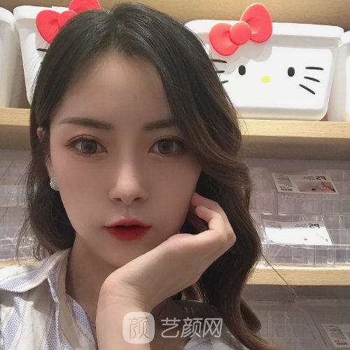 上海李耐国做双眼皮怎么样？2022招牌实例分享