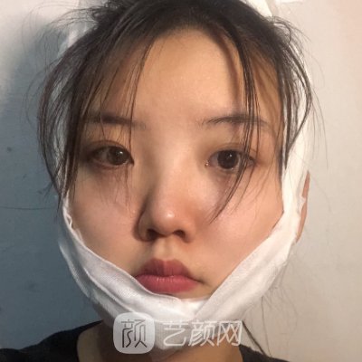 上海时光做下颌角怎么样?医院全新招牌实例曝光