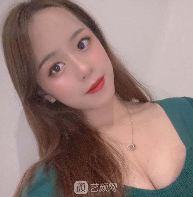 北京八大处隆胸失败修复实例曝光，重塑胸部形态并没那么困难