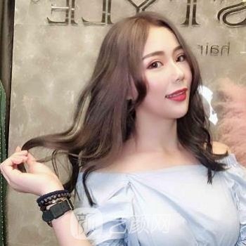 张卓男双眼皮非常新实例，手术修复图片反馈！