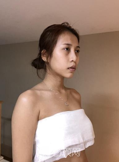才杰隆胸实例图片，术后三个月软糯饱满的胸部请欣赏