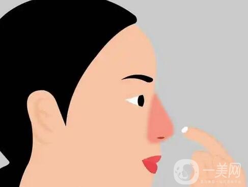 哪些因素决定酒渣鼻整形手术的价格？