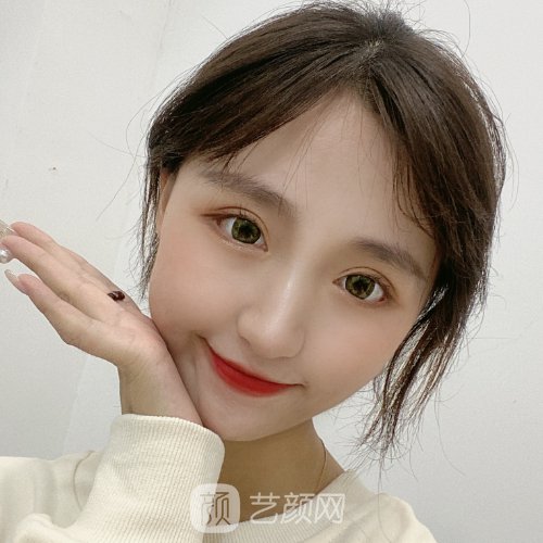 杭州美立方整形医院做眼袋好不好？2023实例展示