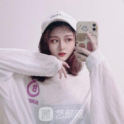 盐城艾美莉整形医院隆鼻实例展示｜体验对比图公开