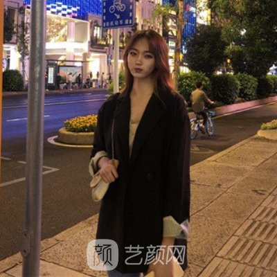 四川华美紫馨整形医院隆鼻实例曝光|附体验成果图