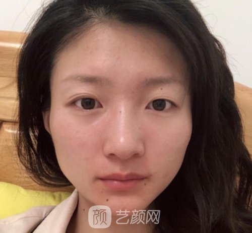 德阳东美整形面部提升怎么样？医生介绍+收费明细表，附实例