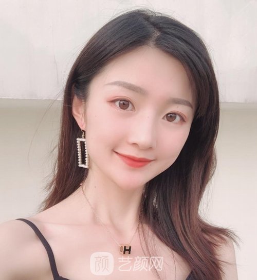 德阳东美整形面部提升怎么样？医生介绍+收费明细表，附实例
