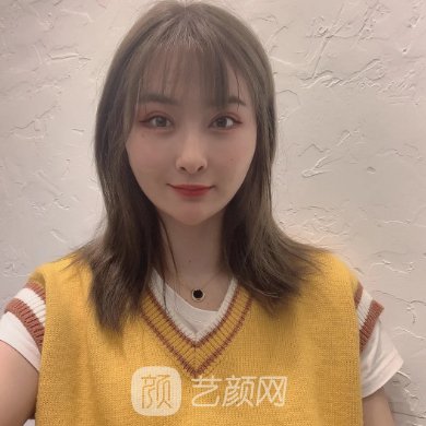 南通康美整形医院玻尿酸除皱成果图展示|成果自然无痕