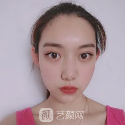上海李湘原做下颌角技术怎么样？医生实力及实例公开