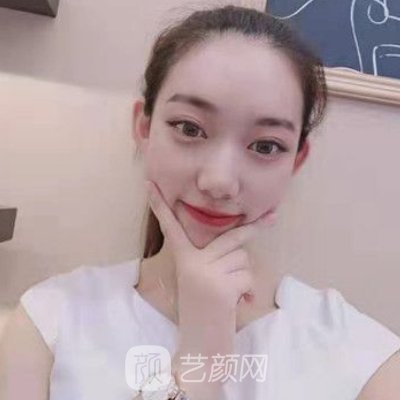 上海李湘原做下颌角技术怎么样？医生实力及实例公开