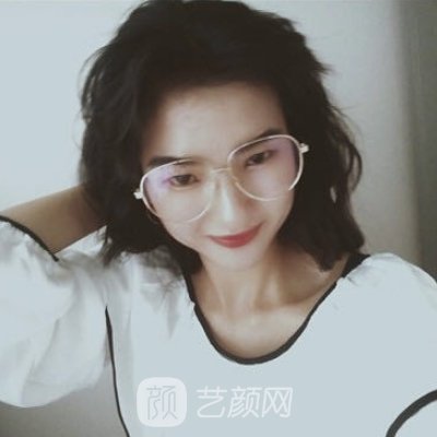 浙江省中医院整形科隆鼻成果怎么样？亲身体验实例曝光