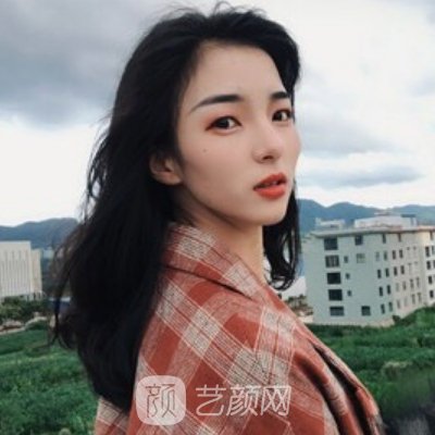 浙江省中医院整形科隆鼻成果怎么样？亲身体验实例曝光