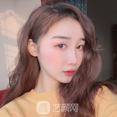 重庆新生正规吗？招牌植发实例曝光