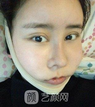 九院史俊医生怎么样？个人简介+正颌手术实例