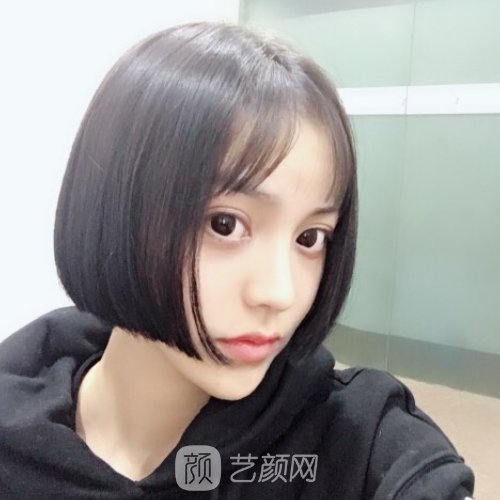 沈阳雍禾种植毛发医院成果靠谱吗？亲身体验对比图展示