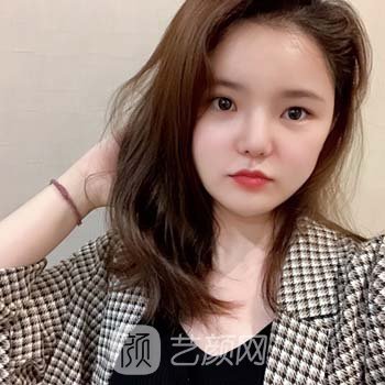长沙鲁青医生隆鼻实例，术后成果真的很自然~