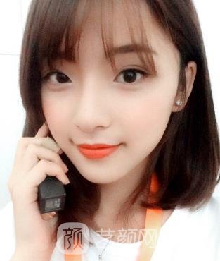 王世虎磨骨实例图，术后漂亮到像是换了一个人