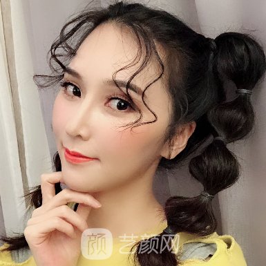 温州和平整形医院隆鼻技术怎么样?崭新体验实例出炉