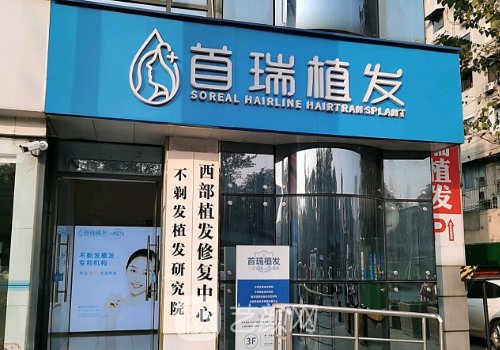 成都首瑞植发医院成果怎么样?全新发际线种植实例分享