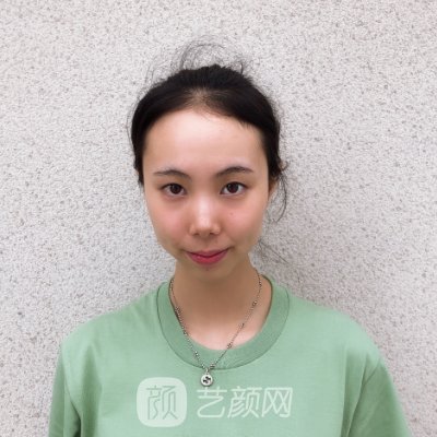 沈阳金皇后做双眼皮好吗?2023招牌实例发布