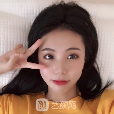 沈阳金皇后做双眼皮好吗?2023招牌实例发布