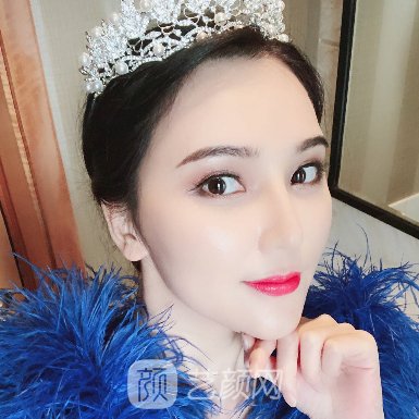 济宁韩美整形医院隆鼻技术怎么样?全新体验实例集中一览