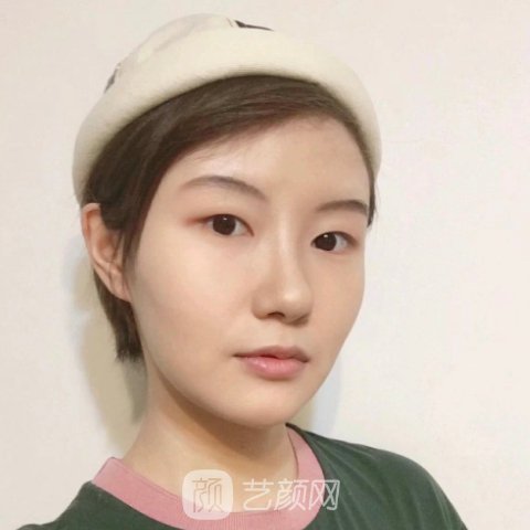 宁波市第一医院整形科除皱嫩肤实例曝光|成果自然美观
