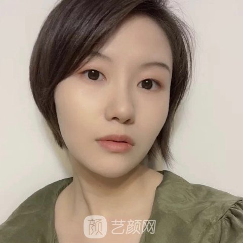 宁波市第一医院整形科除皱嫩肤实例曝光|成果自然美观
