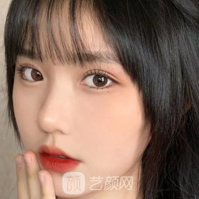 哈尔滨艺星整形医院怎么样?2023双眼皮整形实例分享
