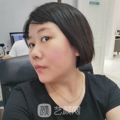 北京联合丽格第一吴焱秋医生疤痕修复实例展示|成果自然美观