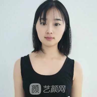 浙一医院整形科隆胸实例曝光|附80天修复细节图
