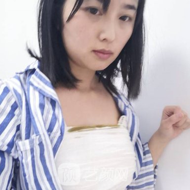 浙一医院整形科隆胸实例曝光|附80天修复细节图