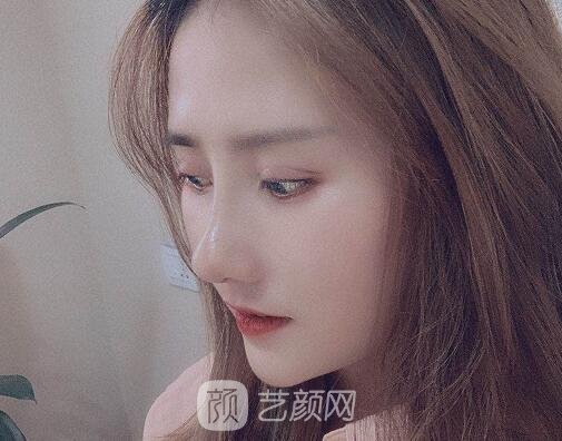 上海灵之水罗飞彪医生做鼻子风格公开｜成果自然无痕